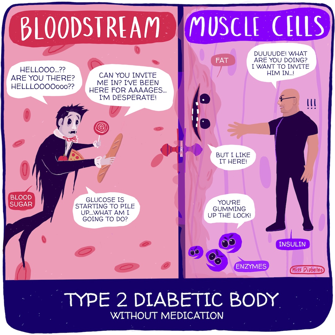Type 2 Diabetic Body